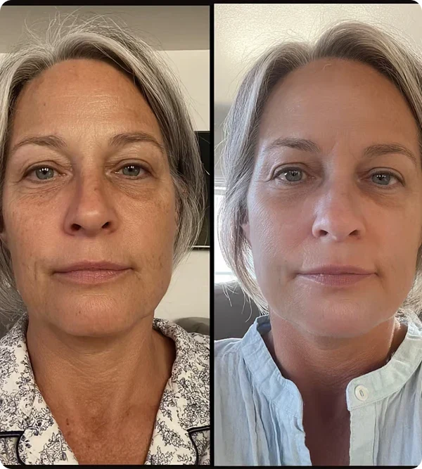 Före och efter – Åsa O, 57 år
