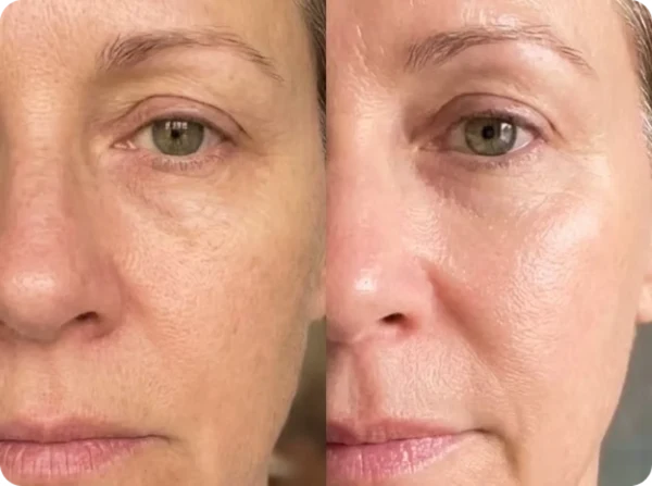 Före och efter – Martina, 49 år